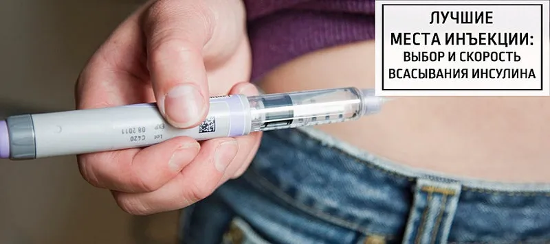 Diabex : къде да купя в България, в аптека?